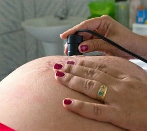 O Ministério Público Federal (MPF) expediu recomendação para que a Assembleia Legislativa do Estado do Amazonas (Aleam) e o Governo do Estado do Amazonas adotem medidas para evitar restrições ao aborto legal.